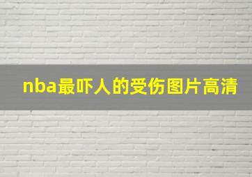 nba最吓人的受伤图片高清