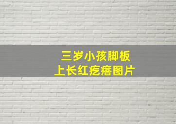 三岁小孩脚板上长红疙瘩图片