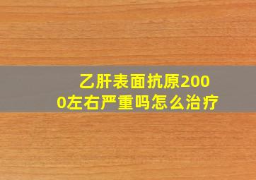 乙肝表面抗原2000左右严重吗怎么治疗