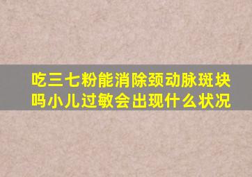 吃三七粉能消除颈动脉斑块吗小儿过敏会出现什么状况