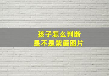 孩子怎么判断是不是紫癜图片