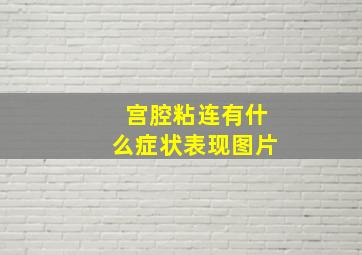 宫腔粘连有什么症状表现图片