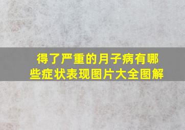 得了严重的月子病有哪些症状表现图片大全图解