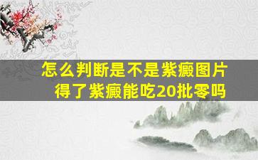 怎么判断是不是紫癜图片得了紫癜能吃20批零吗