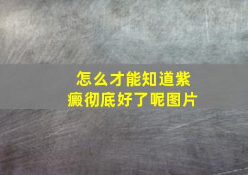 怎么才能知道紫癜彻底好了呢图片