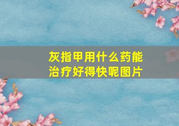 灰指甲用什么药能治疗好得快呢图片