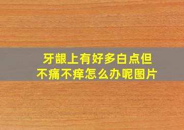 牙龈上有好多白点但不痛不痒怎么办呢图片