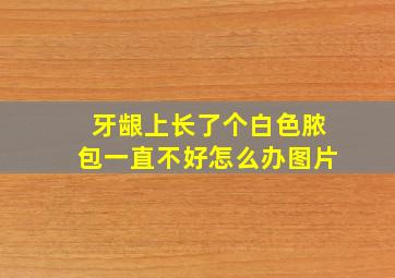 牙龈上长了个白色脓包一直不好怎么办图片