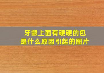 牙龈上面有硬硬的包是什么原因引起的图片