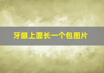 牙龈上面长一个包图片