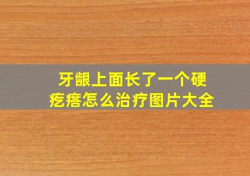 牙龈上面长了一个硬疙瘩怎么治疗图片大全