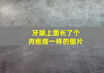 牙龈上面长了个肉疙瘩一样的图片