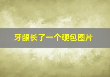 牙龈长了一个硬包图片