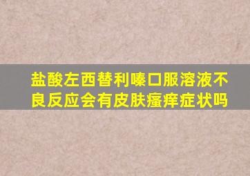 盐酸左西替利嗪口服溶液不良反应会有皮肤瘙痒症状吗