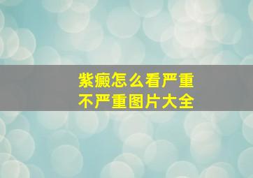 紫癜怎么看严重不严重图片大全