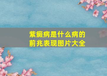 紫癜病是什么病的前兆表现图片大全