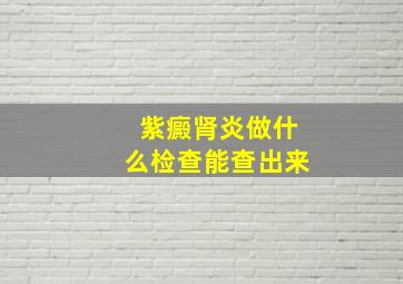 紫癜肾炎做什么检查能查出来