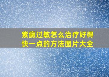 紫癜过敏怎么治疗好得快一点的方法图片大全