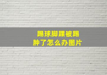 踢球脚踝被踢肿了怎么办图片