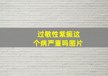 过敏性紫癜这个病严重吗图片